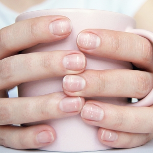 Hands with white spots on nails
